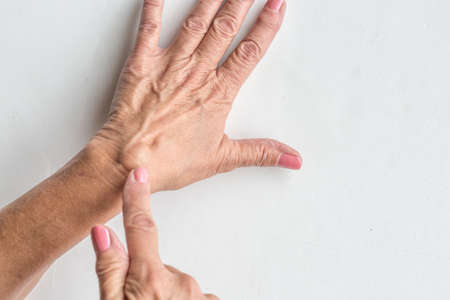 Ganglion cyst on womens handの写真素材