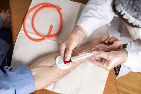 Nurse are taking a venous blood of the patient by syringe. The nurse takes a blood test. View from...
