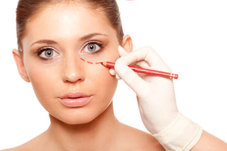 closeup woman face with surgery mark under eyeの写真素材