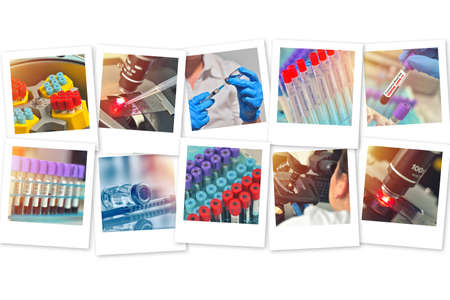 Photo collage with tubes of blood sample for Coronavirus COVID-19 testing. Positive COVID-19 testの写真素材