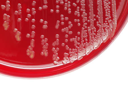 Staphylococcus aureus bacterial colonies on blood agar plateの写真素材