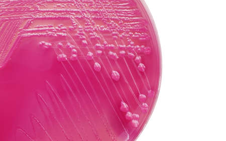 E.coli bacterial colonies on MacConkey agar plate