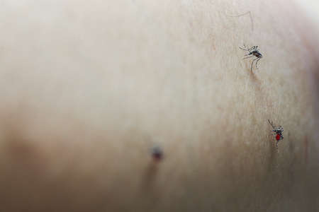 Mosquito biting/sucking into human skin, soft focus medical background.の写真素材