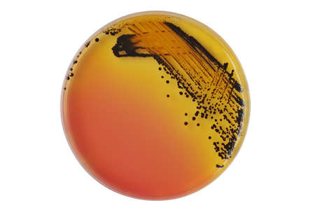 Black bacterial colonies of Salmonella species on Salmonella Shigella agar (SS agar, selective and differential medium) plate on white, medical background.の写真素材