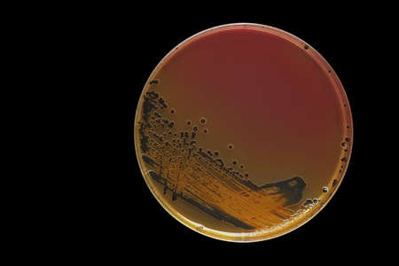 Black bacterial colonies of Salmonella species on Salmonella Shigella agar (SS agar, selective and differential medium) plate on black background, medical abstract background.の写真素材