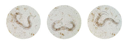 Microscopic view collection of adult free-living female Strongyloides stercoralis, a human pathogenic parasitic roundworm causing the disease strongyloidiasis.の写真素材