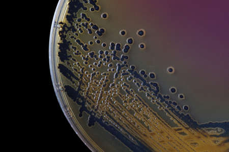 Black bacterial colonies of Salmonella species on Salmonella Shigella agar (SS agar, selective and differential medium) plate on black background, medical abstract background.の写真素材