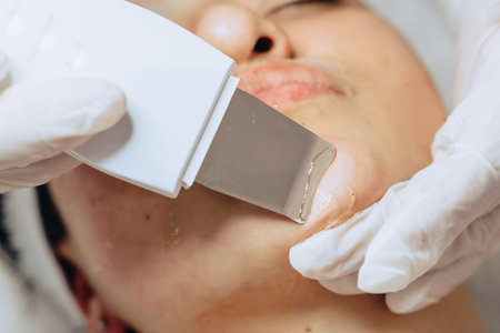 Close-up photo of a young mestiza Colombian woman in a beauty spa where she gets a facial cleansing and goes through the purification step with ultrasounds.の写真素材