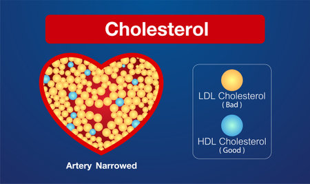 Cholesterol in artery , vector design