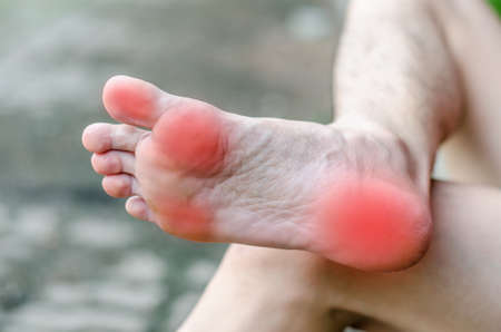 Male foot pain, Man's problem conceptの写真素材