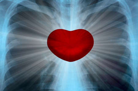 X-Ray Image Close up Of Human Chestの写真素材