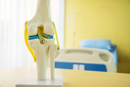 Medical and orthopedic concept, knee joint anatomy model for medical teaching before they are used to describe the patient as a guideline for surgical decision-making on table near patient bed an examination room in a hospitalの素材 [FY310153825044]