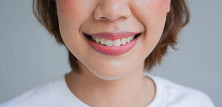close up on asian woman smiling with beautiful tooth for dental healthcare and medical conceptの写真素材