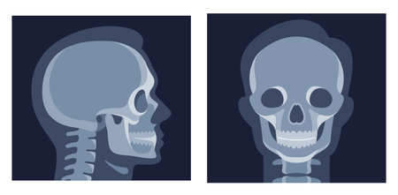 Human head x ray image skull front side view patient medical roentgen vector flatのイラスト素材