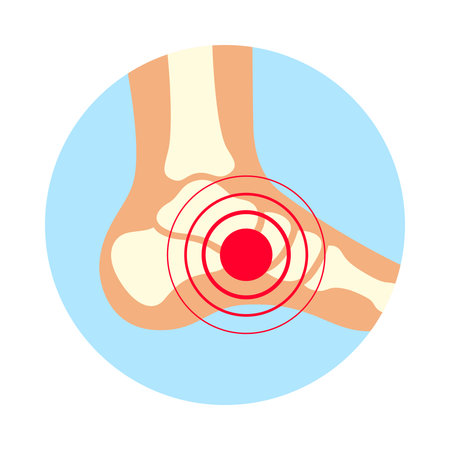 Icon representing ankle pain with focus on joint area and highlighting discomfort through visualsのイラスト素材