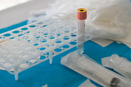 laboratory sample tubes for the  vaccine next to a thermometer on a nurse's table