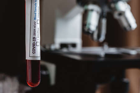 blood Test tube with blood sample for COVID-19 test, novel coronavirus 2019の写真素材