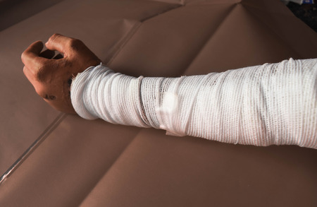 arm woundの写真素材
