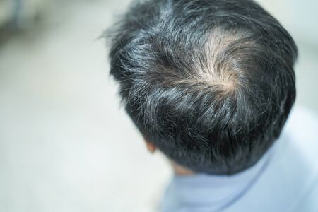 Bold in the middle head and begin no lose hair of mature Asian business smart active office man.の写真素材