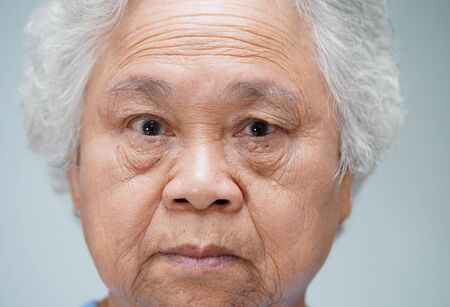 Face of Asian senior or elderly old lady woman close up : healthy strong medical concept.の写真素材