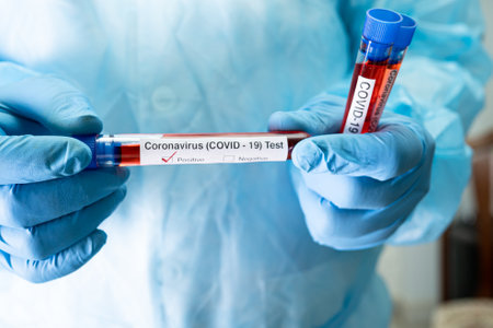 Positive blood infection sample in test tube for covid-19 coronavirus in lab. Scientist holding to...