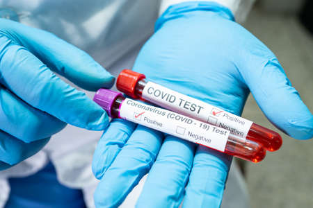 Positive blood infection sample in test tube for covid-19 coronavirus in lab. Scientist holding to...