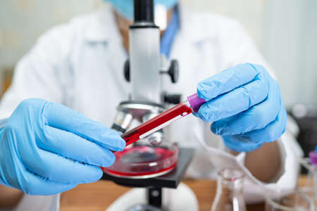 Scientist analysis tube of micro biological in laboratory.