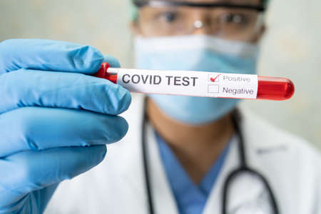 Positive blood infection sample in test tube for covid-19 coronavirus in lab. Scientist holding to check and analyze for patient in hospital.の写真素材