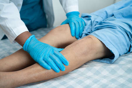 Asian senior or elderly old lady woman patient show her scars surgical total knee joint replacement...