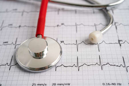 Stethoscope on electrocardiogram ECG, heart wave, heart attack, cardiogram report.の写真素材