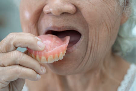 Asian senior or elderly old woman patient holding to use denture in nursing hospital ward, healthy...
