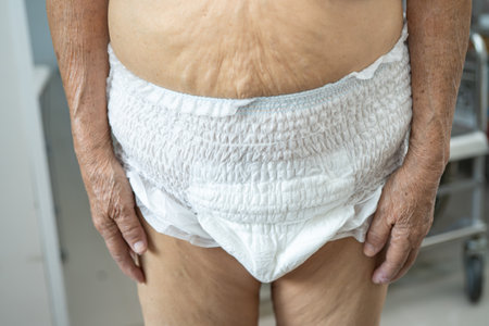 Asian senior or elderly old lady woman patient wearing incontinence diaper in nursing hospital ward, healthy strong medical concept.の写真素材