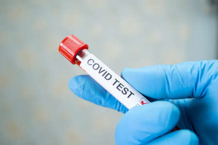 Positive blood infection sample in test tube for covid-19 coronavirus in lab. Scientist holding to check and analyze for patient in hospital.の写真素材
