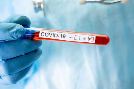 Positive blood infection sample in test tube for covid19 coronavirus in lab. Scientist holding to check and analyze for patient in hospital.の写真素材