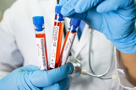 Positive blood infection sample in test tube for covid-19 coronavirus in lab. Scientist holding to...