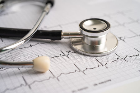 Stethoscope on electrocardiogram ECG, heart wave, heart attack, cardiogram report.の写真素材