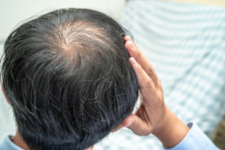 Bald in the middle head and begin no loss hair glabrous of mature Asian business smart active office...