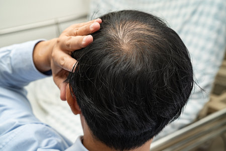 Bald in the middle head and begin no loss hair glabrous of mature Asian business smart active office...