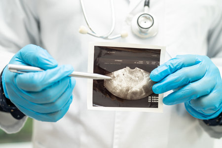 Uterus and ovary, doctor holding anatomy model and ultrasound picture for study diagnosis and...