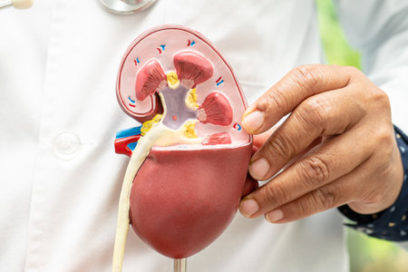 Kidney disease, Chronic kidney disease ckd, Doctor hold model to study and treat in hospital.