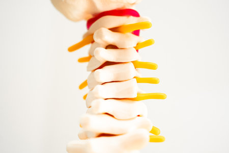 Lumbar spine displaced herniated disc fragment, spinal nerve and bone. Model on white background   for treatment medical in the orthopedic department.の写真素材