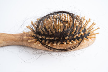 Hair loss fall with comb bush serious problem health, beauty and cosmetic concept.の写真素材