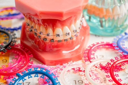 Orthodontic ligatures rings and ties, elastic rubber bands on orthodontic braces, model for dentist studying about dentistry.の写真素材