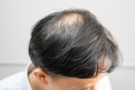 Bald in the middle head and begin no loss hair glabrous of mature Asian business smart active office...