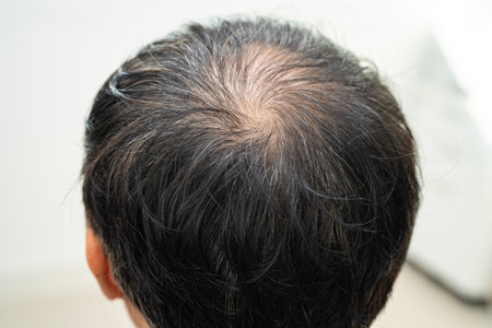 Bald in the middle head and begin no loss hair glabrous of mature Asian business smart active office man.の写真素材