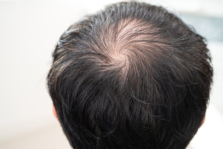 Bald in the middle head and begin no loss hair glabrous of mature Asian business smart active office man.の写真素材