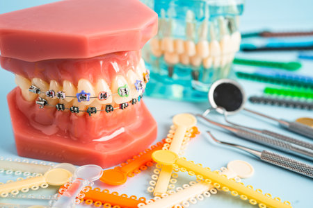 Orthodontic ligatures rings and ties, elastic rubber bands on orthodontic braces, model for dentist...