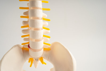 Lumbar spine displaced herniated disc fragment, spinal nerve and bone. Model for treatment medical in the orthopedic department.の写真素材