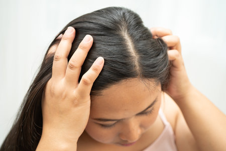 Asian women have problems with itchy scalp and dandruff.の写真素材