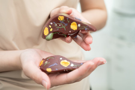 Cirrhosis, Liver cancer, fatty liver, Asian women with liver human anatomy model.